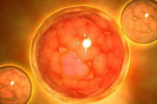 多囊卵巢綜合癥臨床表現(xiàn)有那些？