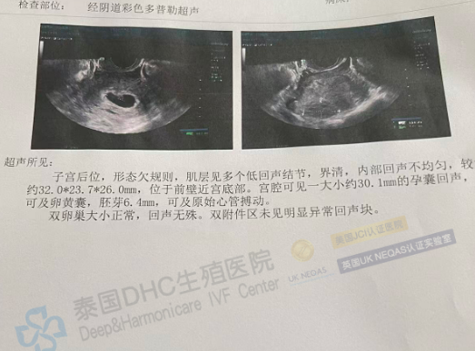 泰國DHC好孕檔案0919：從攻克46%精子碎片率，到見證7周健康心跳