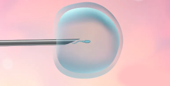 什么是泰國試管嬰兒取卵、取精？