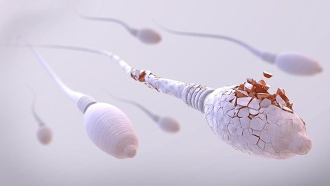 無精癥有什么具體的表現(xiàn)？無精癥的十大表現(xiàn)