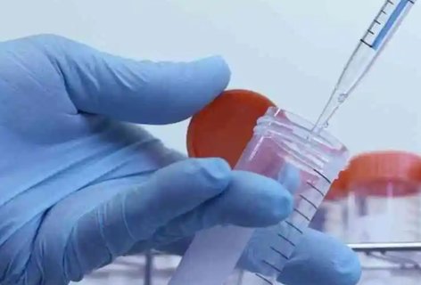 拮抗劑方案具體流程是什么？試管拮抗劑方案流程步驟