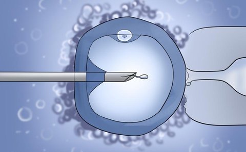 卵泡穿刺就會(huì)排卵嗎？解析卵泡穿刺與排卵的關(guān)系