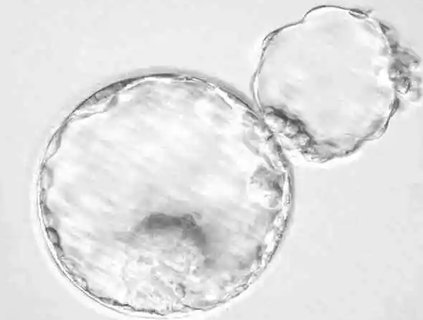 輔助孵化能提高成功率嗎？揭秘輔助孵化技術(shù)的影響