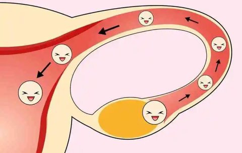 哪類人容易輸卵管堵塞？容易輸卵管堵塞的人