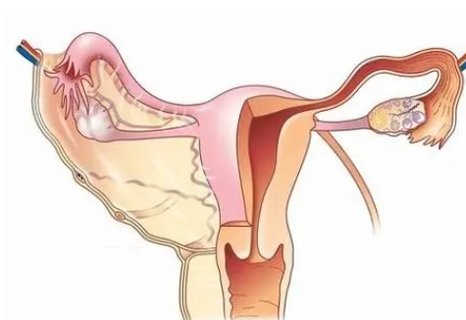 沒(méi)有輸卵管可以做試管嗎？試管嬰兒技術(shù)解決問(wèn)題