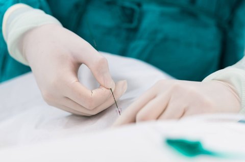 試管減胎對另一個(gè)有影響嗎？對另一胎兒的潛在影響